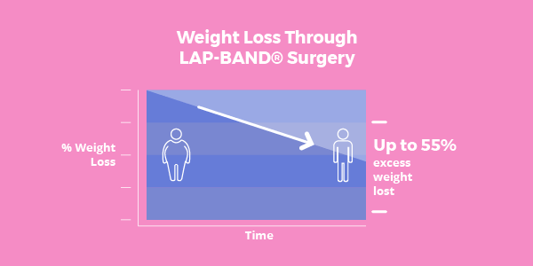 LAPBAND® Surgery All You Need to Know Bariatric