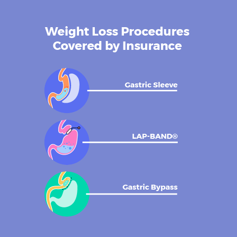 bariatric permanente