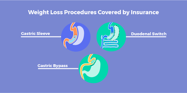 Excellus BCBS Weight Loss Surgery - How to Avoid a Denial - Bariatric ...