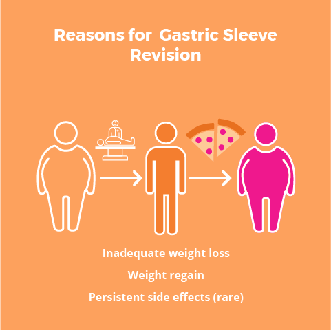 Gastric Sleeve Revision - How to Get to Your Goal Weight