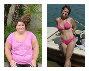 Gastric Sleeve Diet - How Successful Patients Eat Before & After